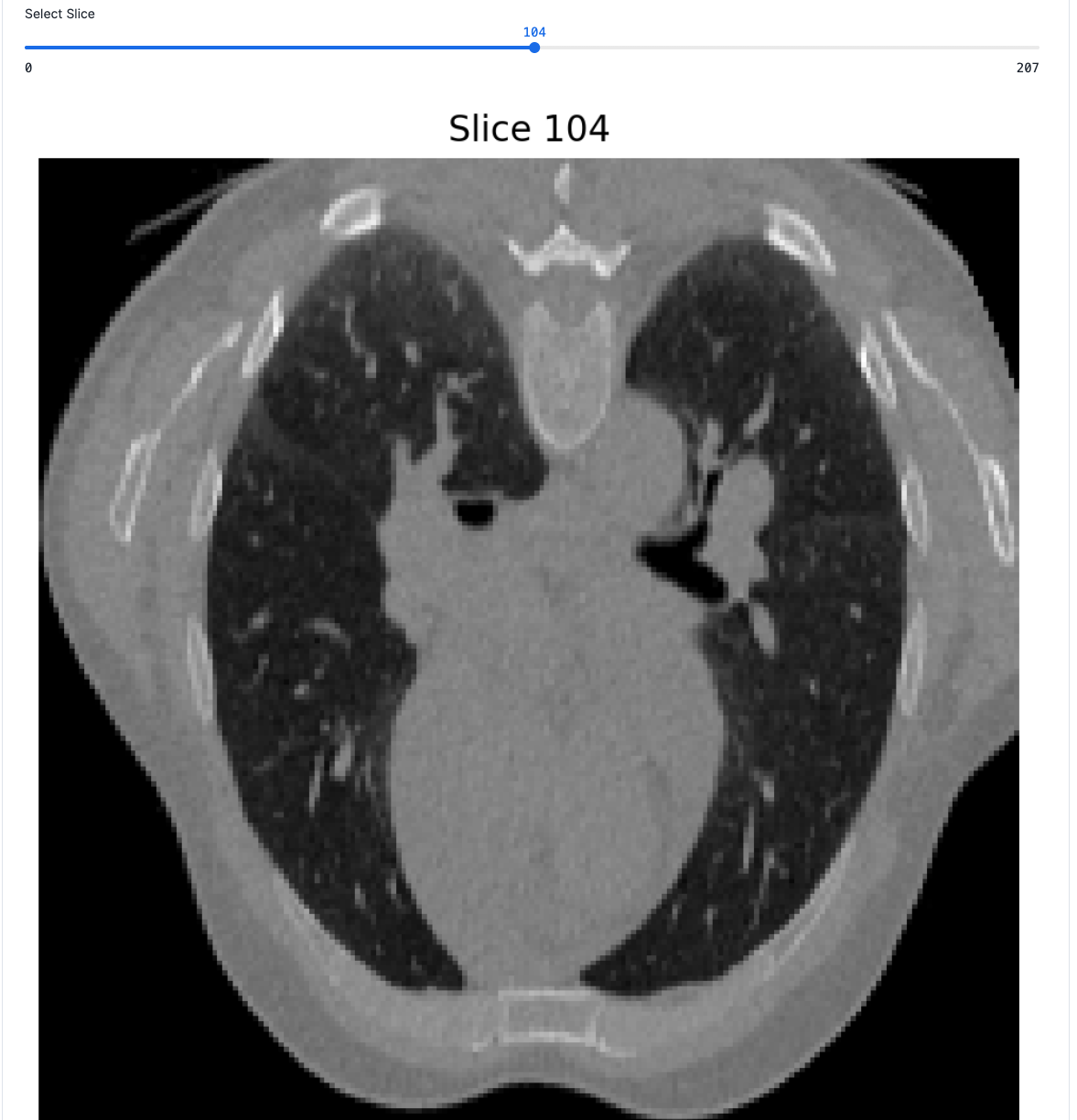 CT Scan Visualization